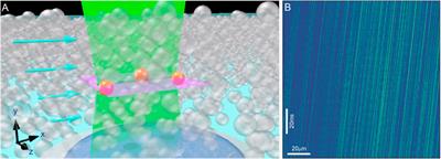 Precise and accurate speed measurements in rapidly flowing dense suspensions